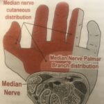 carpal-tunnel-syndrome-osteopathy